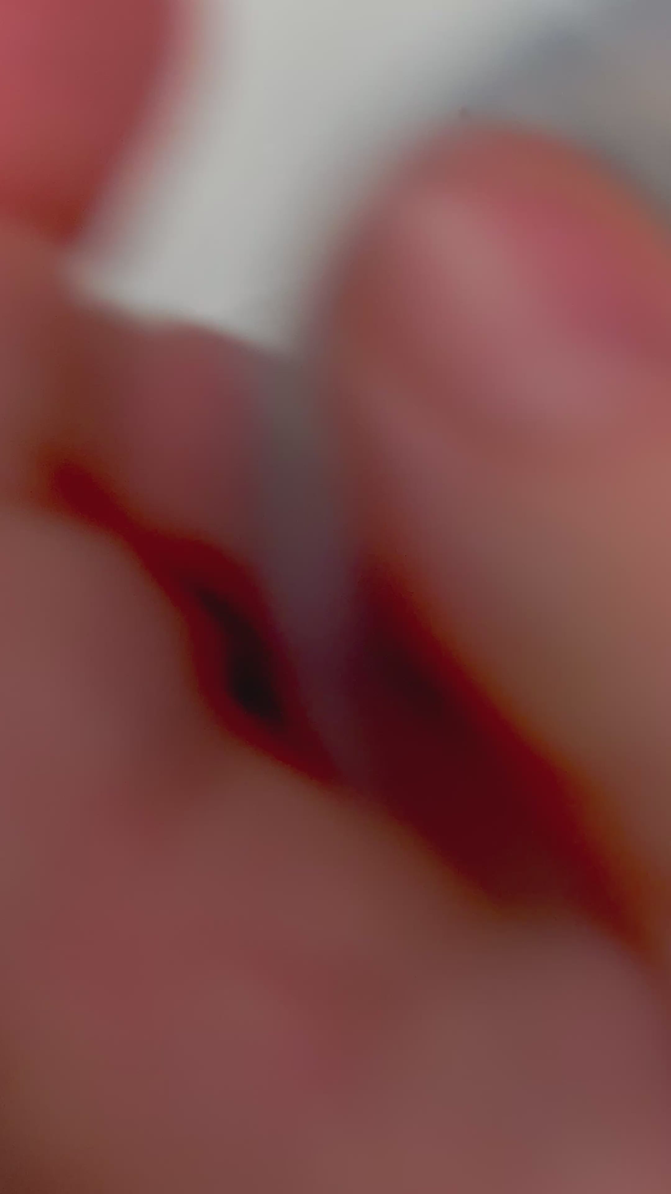 Load video: Pick &#39;Em Starter Set - Kaiko Picking, Popping &amp; Hair Pulling Support